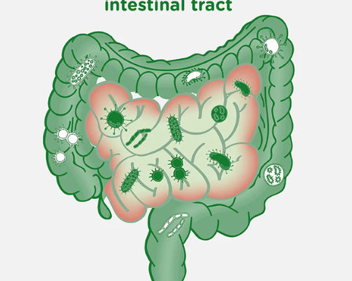 Gut Dysbiosis and SIBO